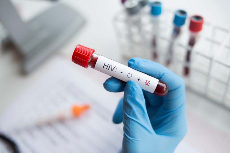 Un test HIV